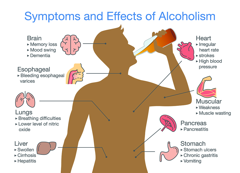 alcoholism effects and symptoms